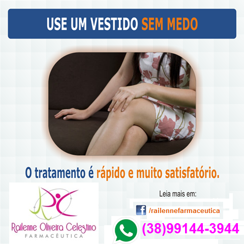 1 sessão de escleroterapia